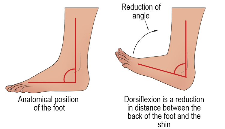 Therefore, dorsiflexion is the decrease in angle from the back of the foot towards the shin.